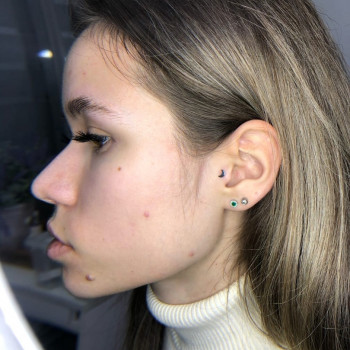 Лиса, Moscow Фото - 5