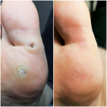 Tatiana Bogorad, Wroclaw Фото - 6