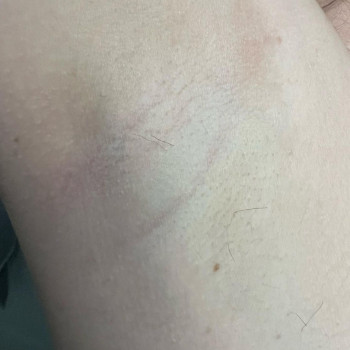 Inhype, Wrocław Фото - 5