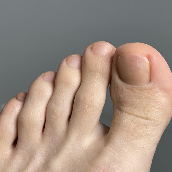 Гигиенический педикюр