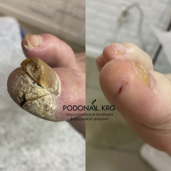 Даурия Байконова, Karaganda Фото - 6