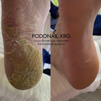 Даурия Байконова, Karaganda Фото - 7