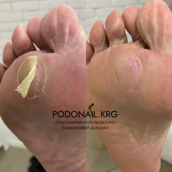 Даурия Байконова, Karaganda Фото - 8