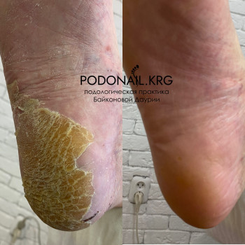 Даурия Байконова, Karaganda Фото - 10