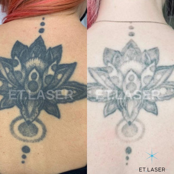 Et.Laser, Moscow Фото - 5