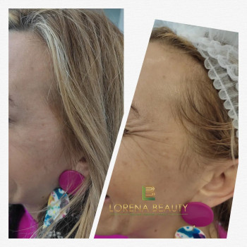 Lorena Beauty, Bydgoszcz Фото - 5