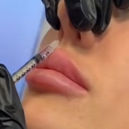 Lekarz medycyny estetycznej Ирина Essentuki,