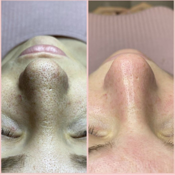 Алина Авшалумова, Lyubertsy Фото - 6