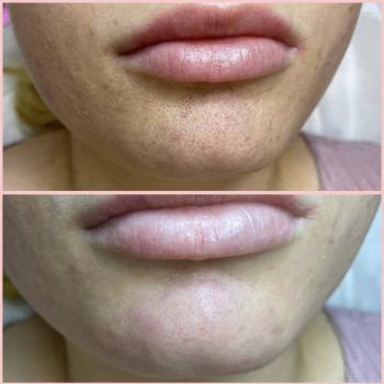 Алина Авшалумова, Lyubertsy Фото - 7