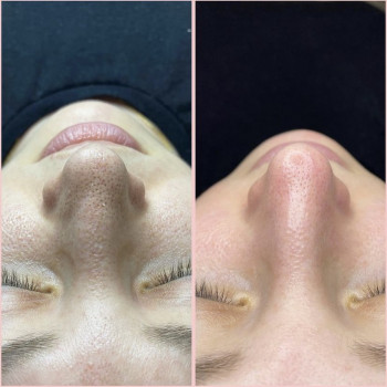 Алина Авшалумова, Lyubertsy Фото - 8