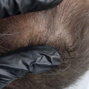 Трихопигментация 
                    Мастер перманентного макияжа, трихопигментации Алена Бодрова Saint Petersburg