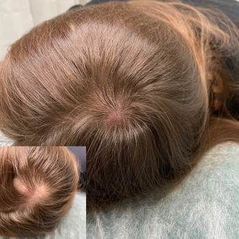 Трихопигментация 
                    Мастер перманентного макияжа, трихопигментации Алена Бодрова Saint Petersburg