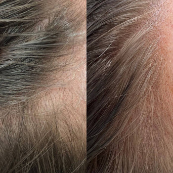 Алена Бодрова, Санкт-Петербург Фото - 12