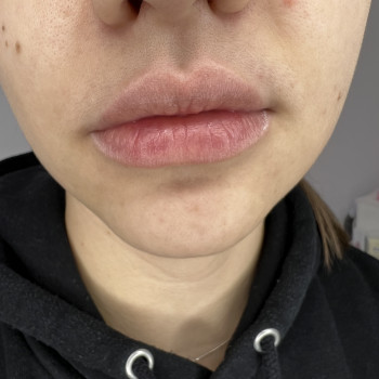 До 
Хорошая форма, нужно только придать цвет 