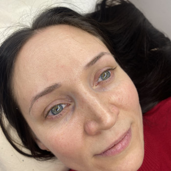 До 
Остался татуаж
Сводили три раза 
Принято решение пере