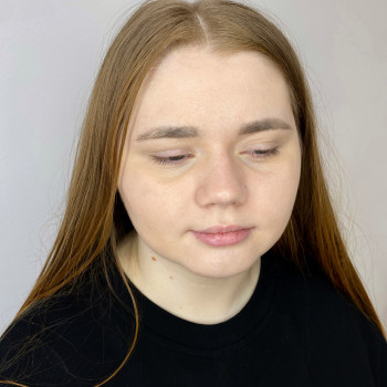 До 
Хорошая форма губ
Есть небольшая асимметрия нижней губ