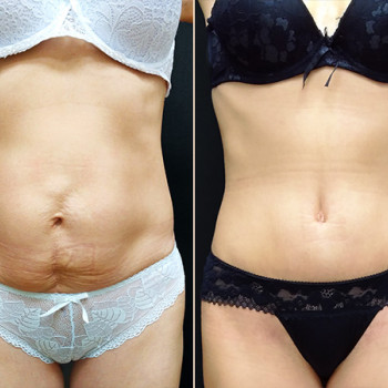 Anturium, Barnaul Фото - 6