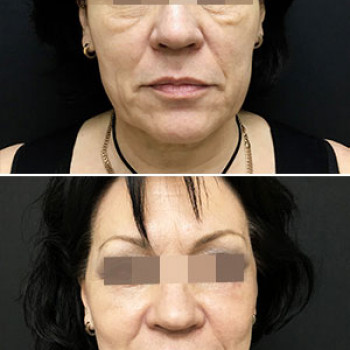 Anturium, Barnaul Фото - 7