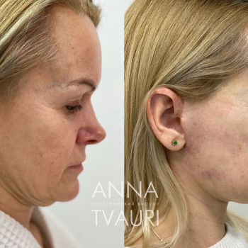 Анна Тваури, Moscow Фото - 7