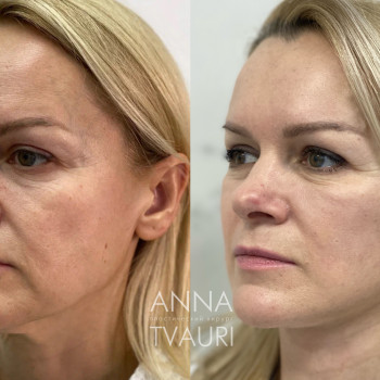 Анна Тваури, Moscow Фото - 8