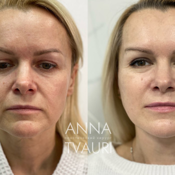 Анна Тваури, Moscow Фото - 9