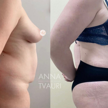 Анна Тваури, Moscow Фото - 10