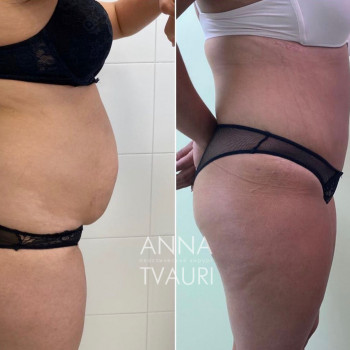 Анна Тваури, Moscow Фото - 11