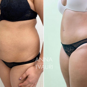 Анна Тваури, Moscow Фото - 12