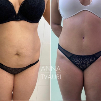 Анна Тваури, Moscow Фото - 13