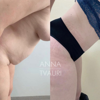 Анна Тваури, Moscow Фото - 14