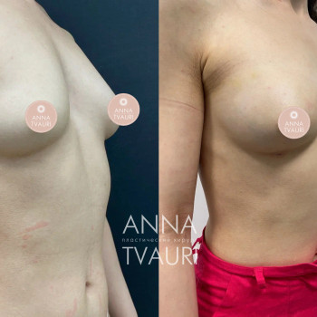 Анна Тваури, Moscow Фото - 15