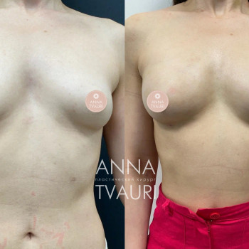 Анна Тваури, Moscow Фото - 16