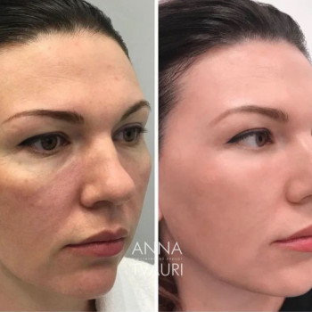 Анна Тваури, Moscow Фото - 17