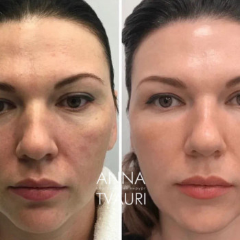 Анна Тваури, Moscow Фото - 18