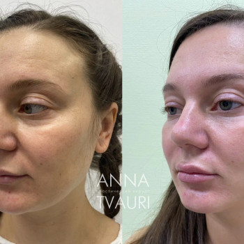 Анна Тваури, Moscow Фото - 19