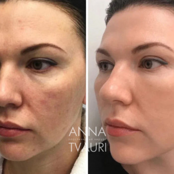 Анна Тваури, Moscow Фото - 20