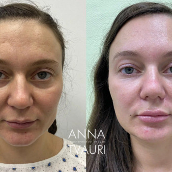 Анна Тваури, Moscow Фото - 21