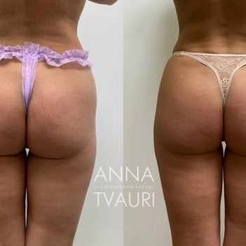 Анна Тваури, Moscow Фото - 23