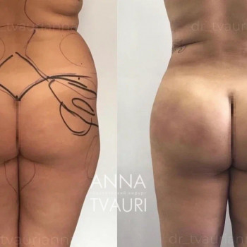 Анна Тваури, Moscow Фото - 24