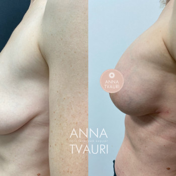 Анна Тваури, Moscow Фото - 25