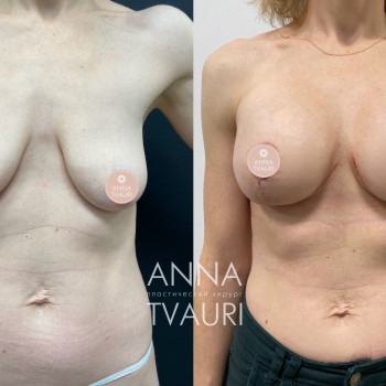 Анна Тваури, Moscow Фото - 26