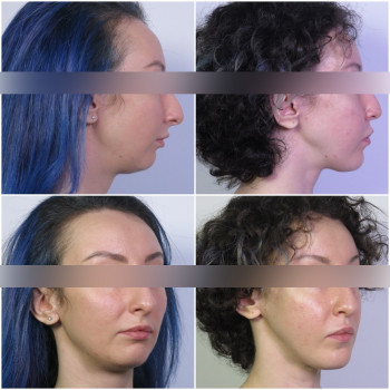 Андрей Русланович Андреищев, Saint Petersburg Фото - 5