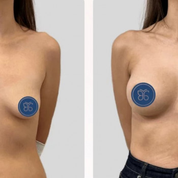 Вячеслав Валерьевич Балкизов, Krasnogorsk Фото - 5