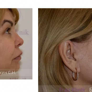 Сергей Николаевич Блохин, Moscow Фото - 5