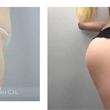 Сергей Николаевич Блохин, Moscow Фото - 6