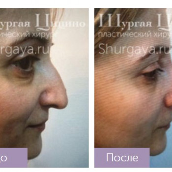 Цицино Шургая, Moscow Фото - 5