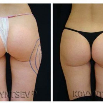 Николай Николаевич Ковынцев, Moscow Фото - 5