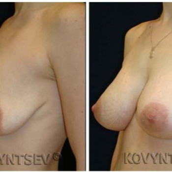 Николай Николаевич Ковынцев, Moscow Фото - 6