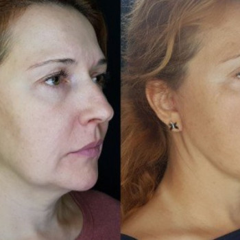 Вячеслав Петрович Грибков, Moscow Фото - 5