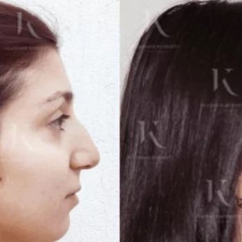 Владимир Александрович Косинец, Moscow Фото - 5